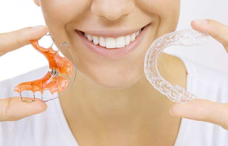 矯正治療で使用するワイヤーとマウスピースの矯正装置を持っている女性