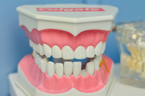 歯茎の黒ずみを解消する「歯茎ピーリング」って知ってる？